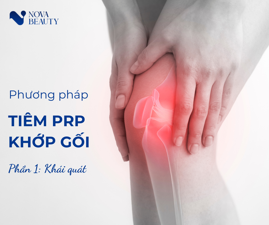 Tìm hiểu về tiêm huyết tương giàu tiểu cầu (PRP) điều trị thoái hóa khớp gối