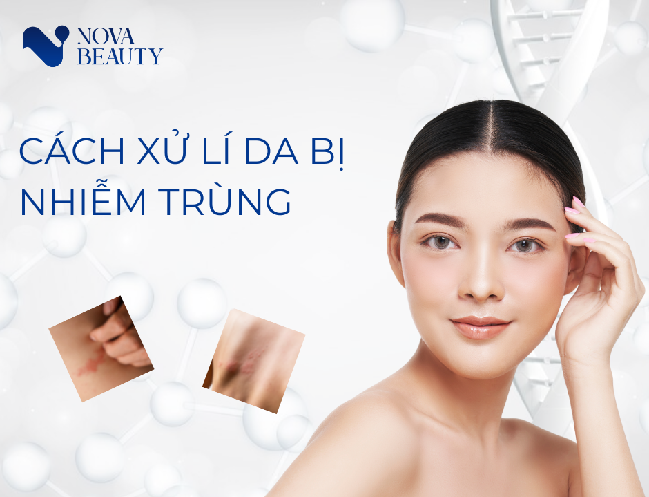 Cách xử lý tình trạng nhiễm trùng da