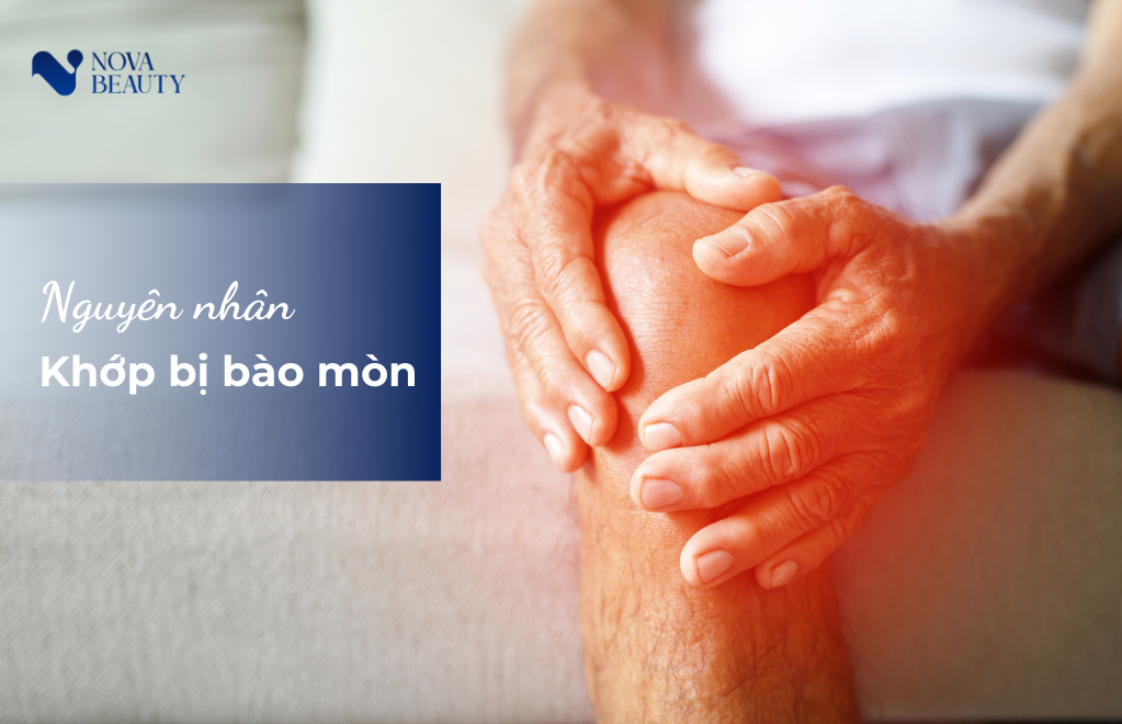 Sụn khớp bị bào mòn do đâu?