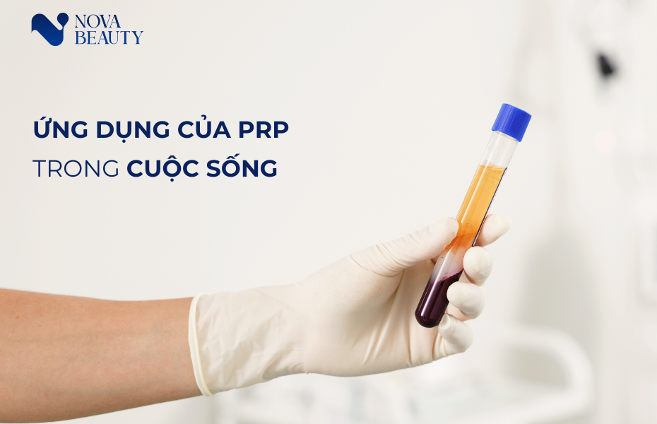 Huyết tương giàu tiểu cầu PRP và ứng dụng