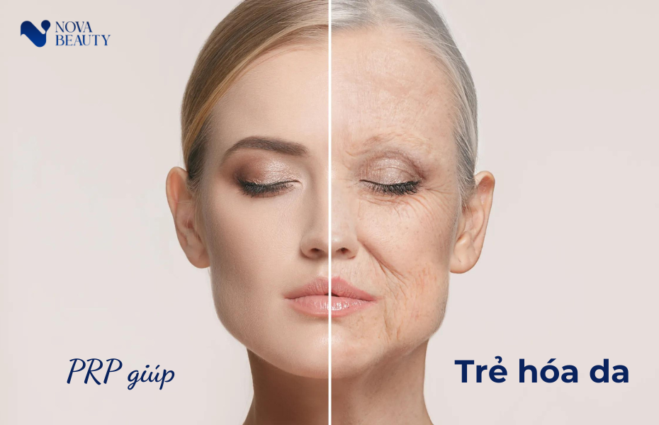 PRP trong việc trẻ hóa da